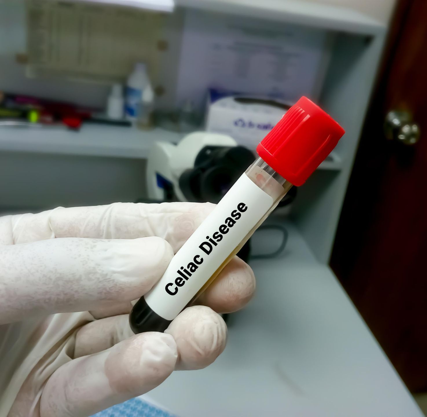 Wykrycie celiakii umożliwiają odpowiednie testy