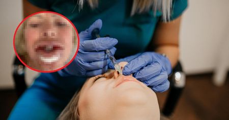Wielokrotnie korzystała z popularnego zabiegu. Diagnoza ją zdruzgotała