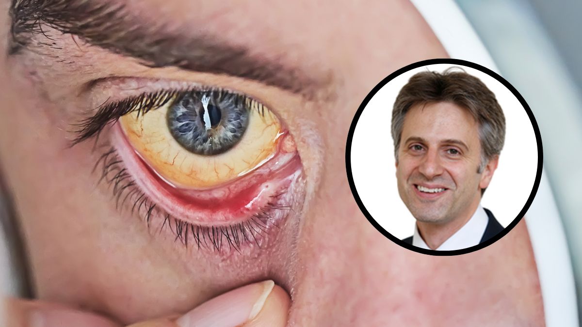 Ekspert wyjaśnia, co jest prawdą, a co mitem przy WZW