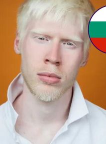 Albino Models Who Have Changed the Fashion Industry