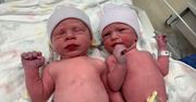 "Najstarsze zarodki świata". Tak wyglądają rekordowe bliźnięta po porodzie