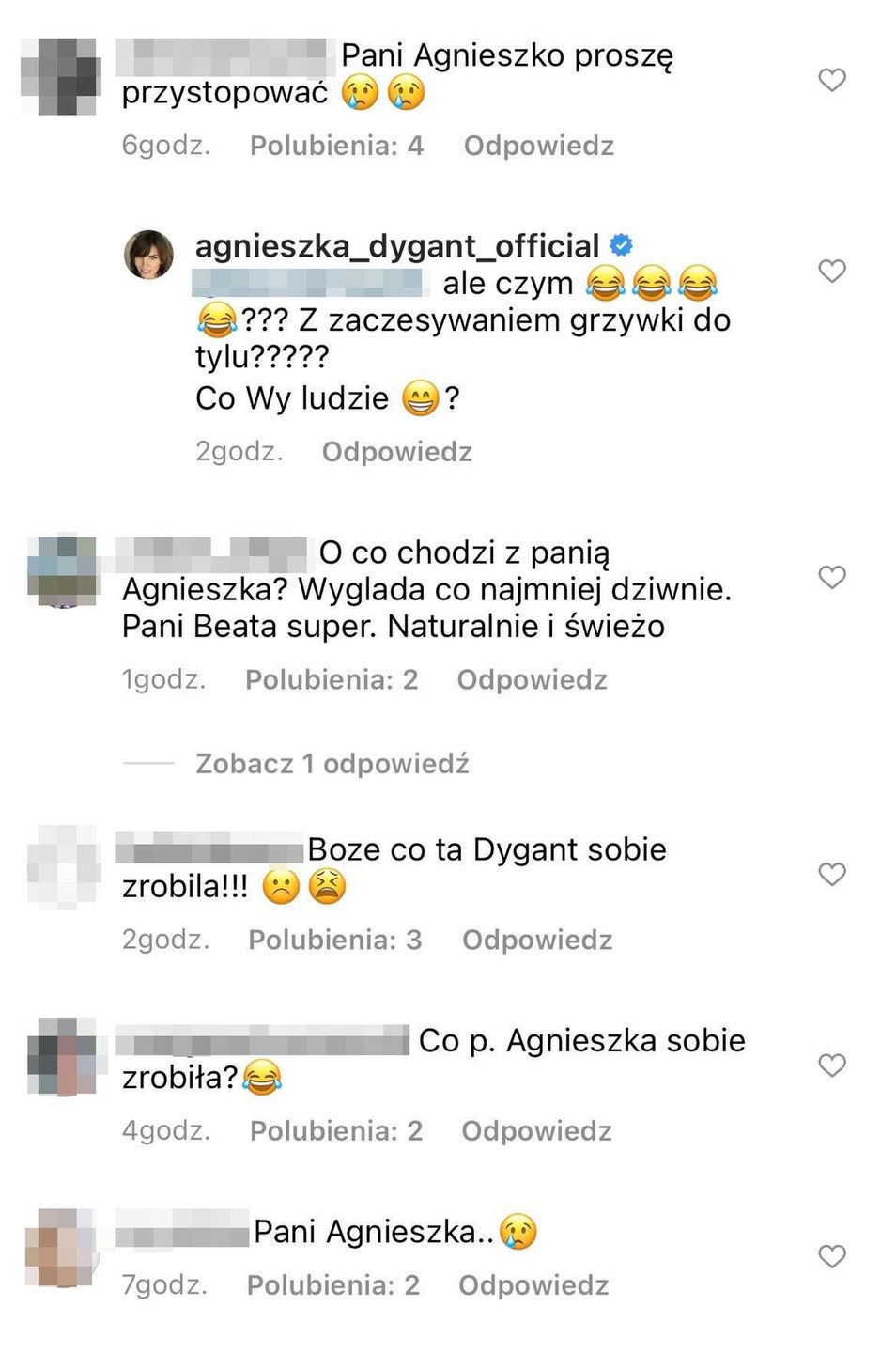 Agnieszka Dygant odpowiada na zarzuty internautów o operowanie się