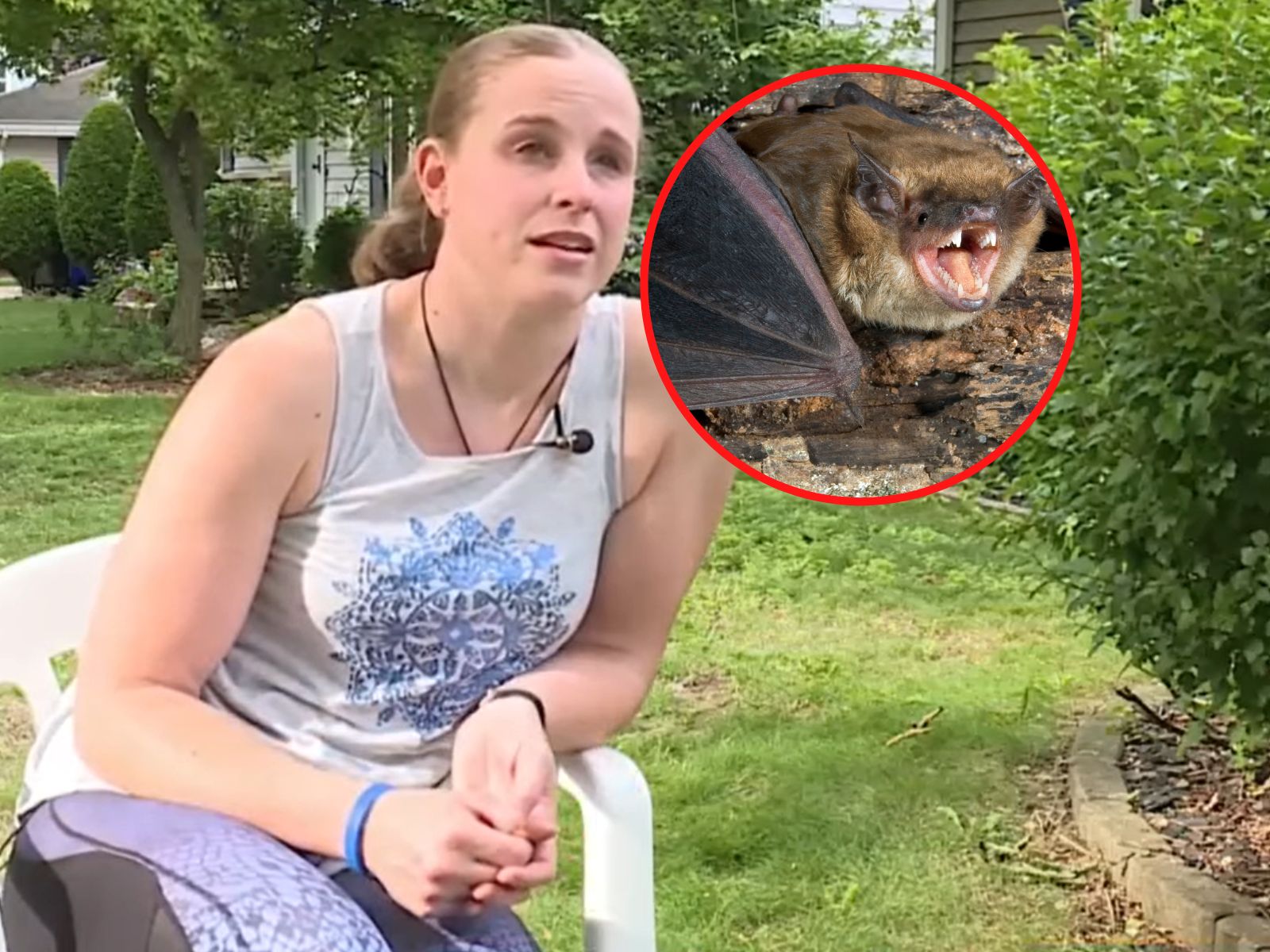 Jenna została uratowana dlatego, że przeszła łagodną odmianę wścieklizny