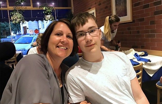 Włosy wrastały nastolatkowi w plecy