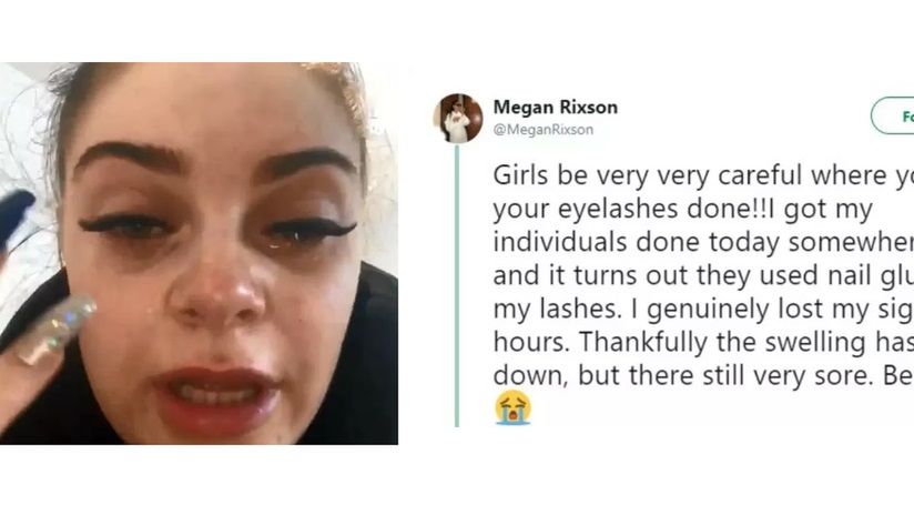 Megan Rixson straciła wzrok przez sztuczne rzęsy przyklejone klejem do paznokci. Teraz ostrzega innych