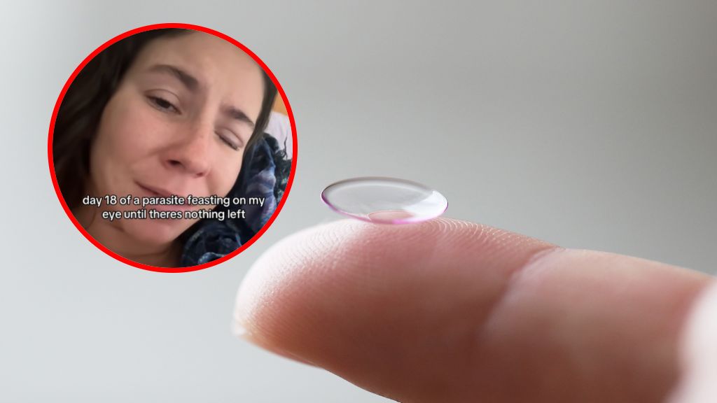 21-latka ostrzega przed nieprawidłowym noszeniem soczewek