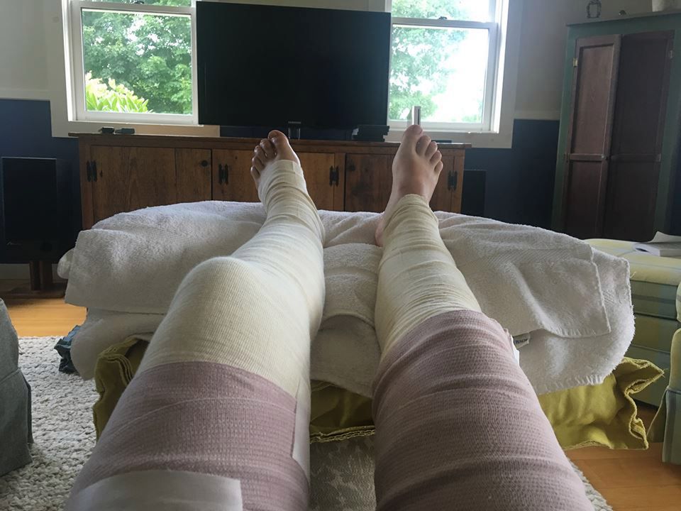 Kobieta przeszłe długie leczenie i dalej dochodzi do zdrowia