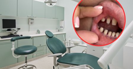 Tureckie zęby kuszą Polaków. Eksperci biją na alarm