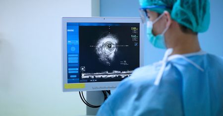 Ultrasonografia wewnątrznaczyniowa – charakterystyka, wskazania i przebieg badania