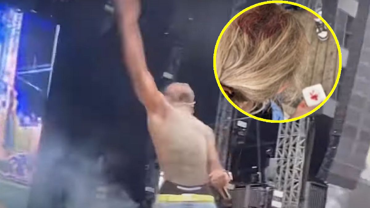 Lil Uzi Vert trafił telefonem w głowę fanki