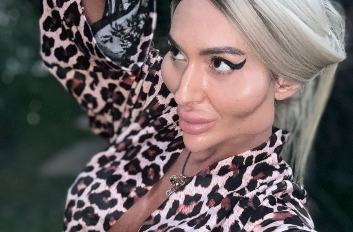 Ukrainian model with 'world's biggest cheeks' defies critics