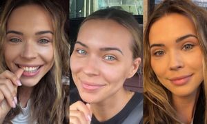 Sandra Kubicka pokazała się 20 dni po operacji powiek. "Zawsze chciałam mieć duże, otwarte oczy" (FOTO)