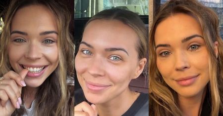 Sandra Kubicka pokazała się 20 dni po operacji powiek. "Zawsze chciałam mieć duże, otwarte oczy" (FOTO)