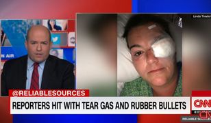 Dziennikarka straciła oko w starciach w Minneapolis