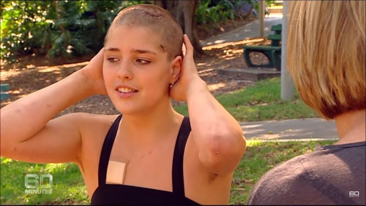 Bianca cierpiała na zespół Tourette'a