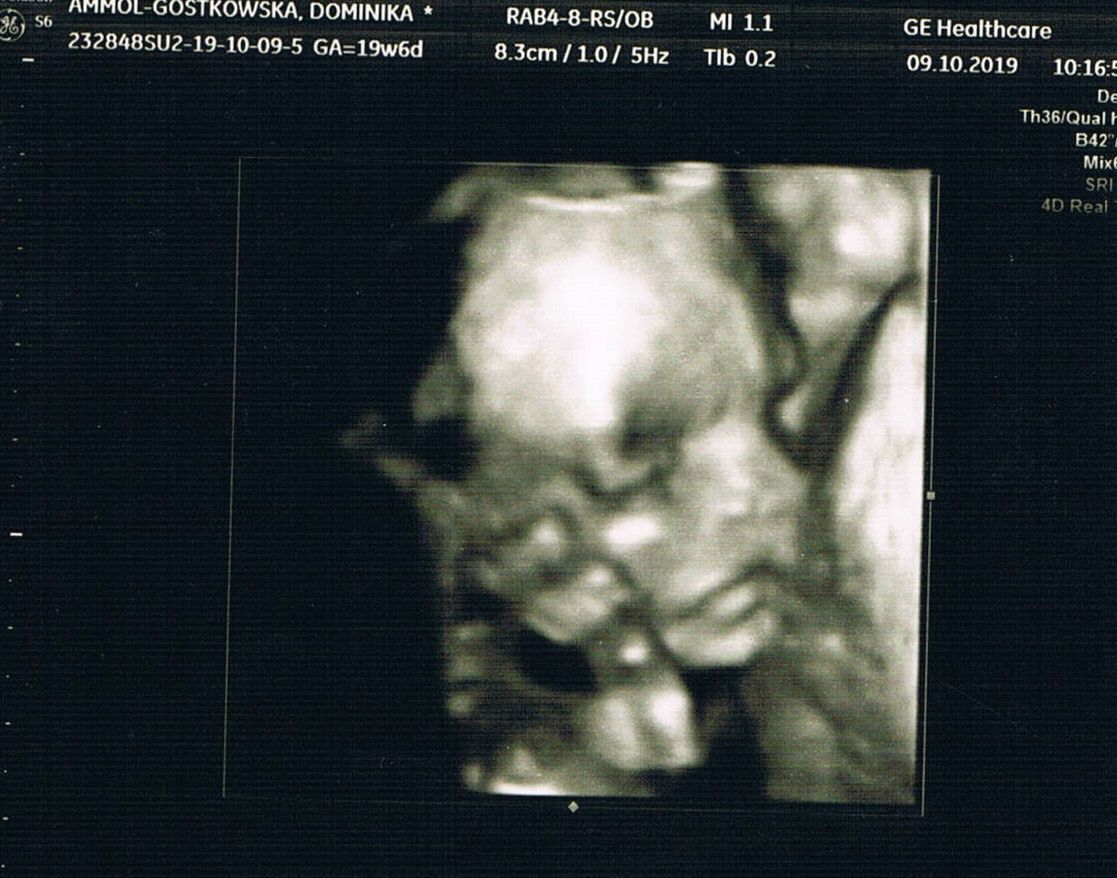 Badanie USG Wojtusia.