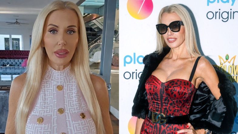 Aneta Glam do niedawna była stałą bywalczynią klinik medycyny estetycznej