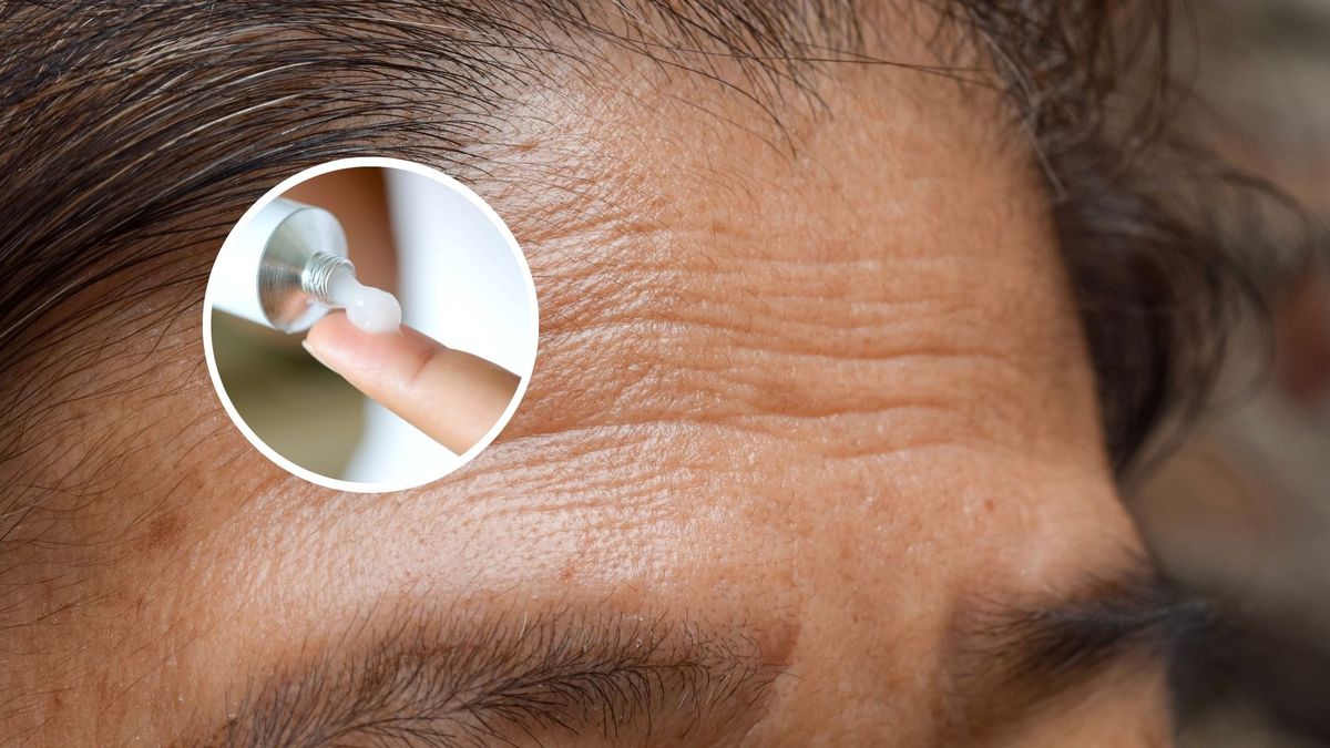 Jak działa na skórę maść tranowa? 