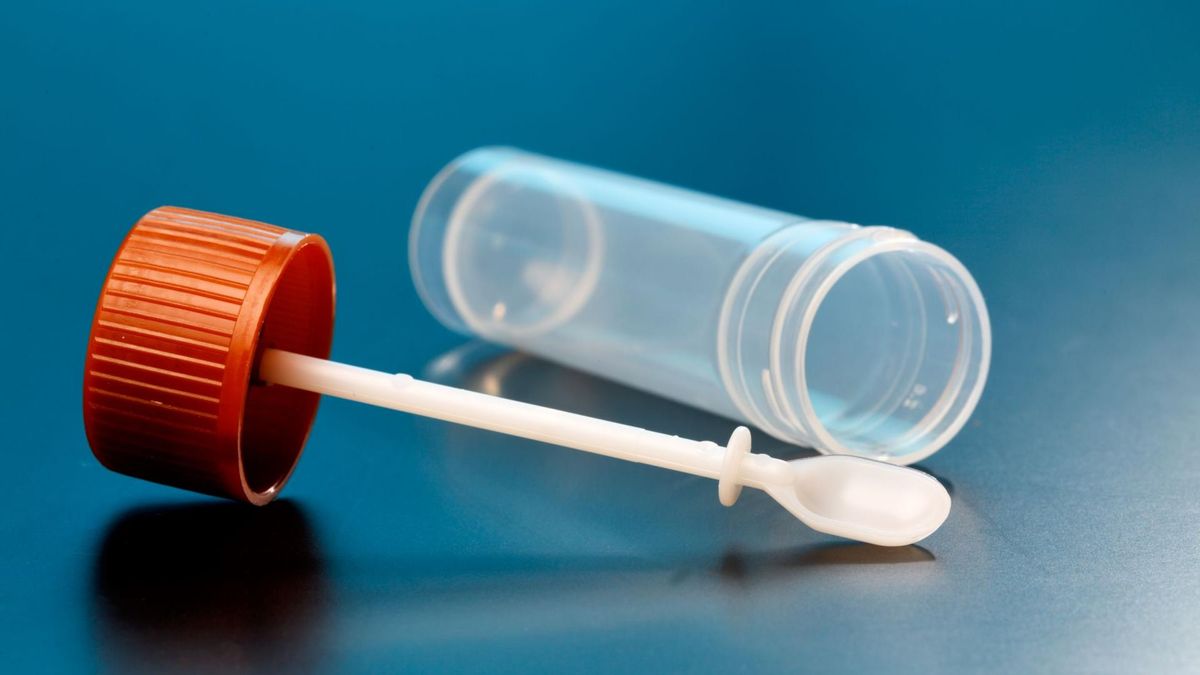 Oprócz krwi utajonej, krew w stolcu może występować w formie smolistego kału