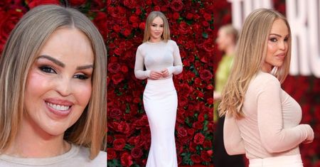Oblana kwasem przez byłego Katie Piper błyszczy na premierze filmu. Prezenterka ma za sobą 400 zabiegów