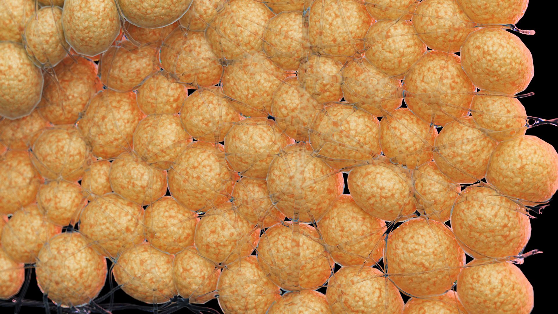 Wysoki cholesterol zwiększa ryzyko udaru mózgu