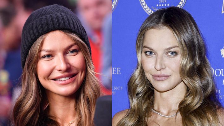 Lekarka ocenia "nową" twarz Anny Lewandowskiej