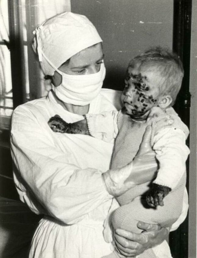 Pielęgniarka z Wrocławia z chorym dzieckiem podczas epidemii odry (1963).