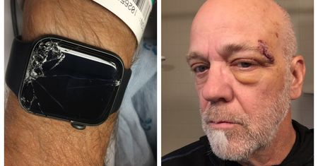 Apple Watch uratował go przed śmiercią. Smartwatch wykrył upadek i wezwał pomoc