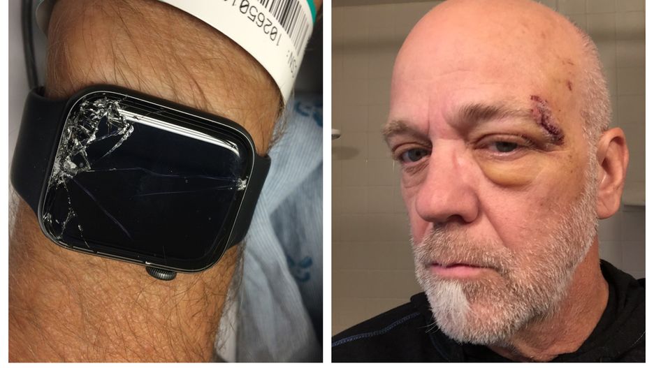Apple Watch Series 4 posiada funkcję wykrywania upadku