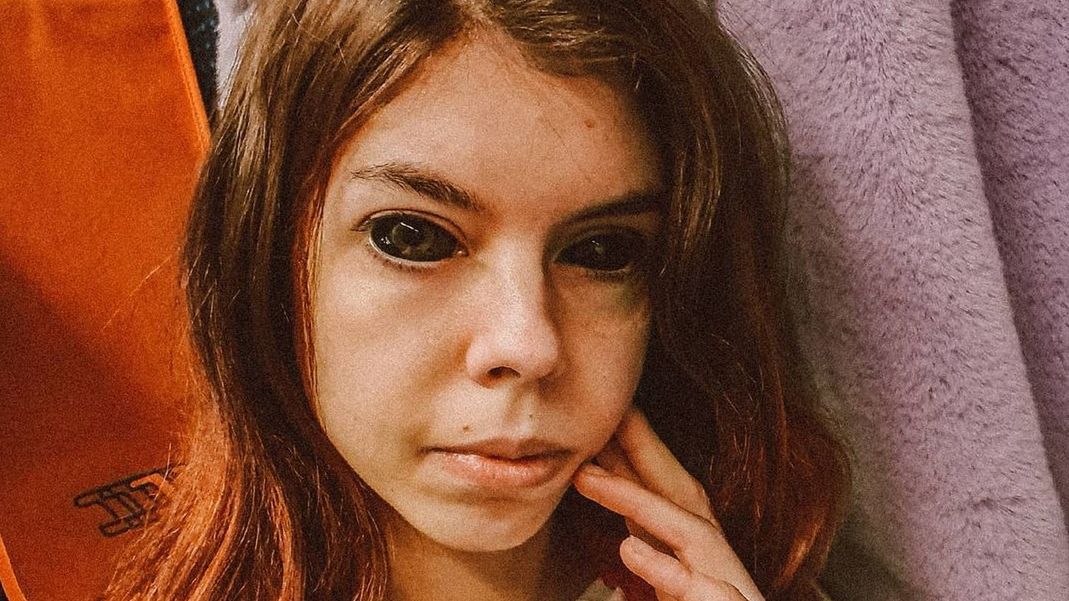 Aleksandra wytatuowała sobie gałki oczne i straciła wzrok
