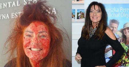 Agnieszka Perepeczko zakrwawioną twarzą "reklamuje" wampirzy lifting: "Queen of beauty"