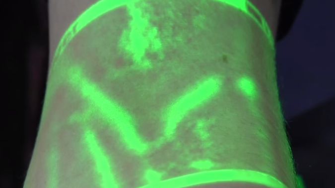 Film dnia: Koniec z pomyłkami pielęgniarek! Urządzenie wykryje żyły i zaoszczędzi nam bólu 1