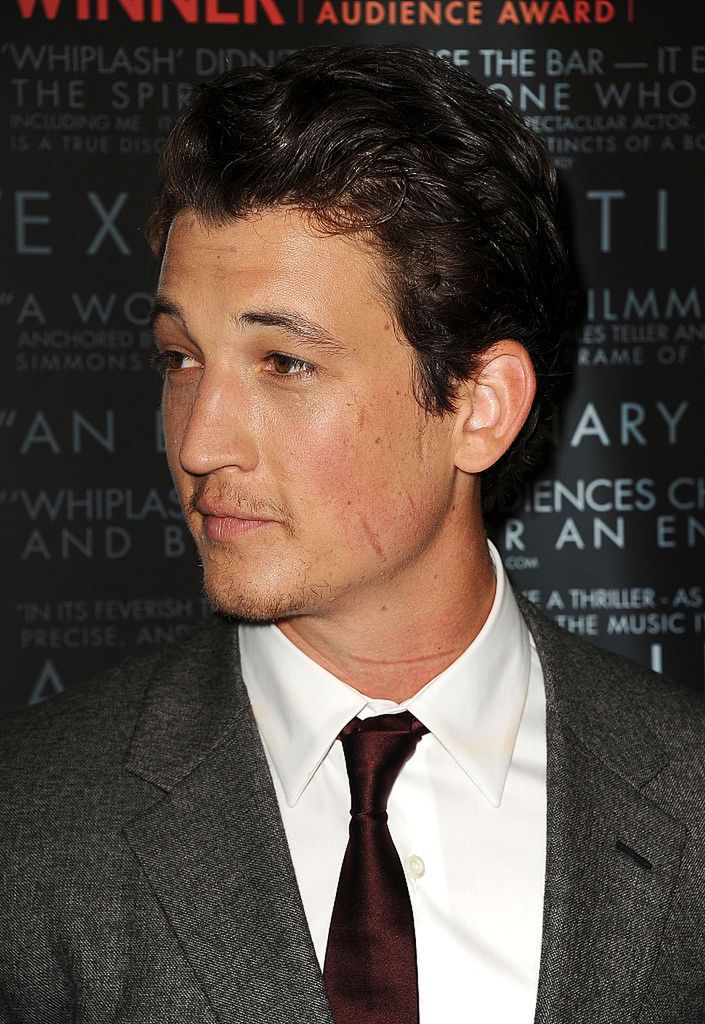 Blizny stały się jego atutem w Hollywood