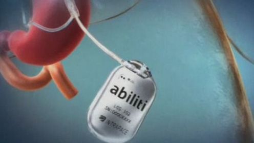 Abiliti - elektronika w brzuchu człowieka 1