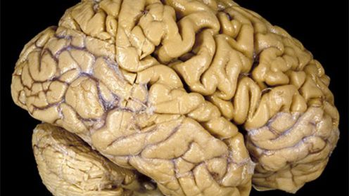 Intel pracuje nad sterowaniem przy pomocy umysłu 1