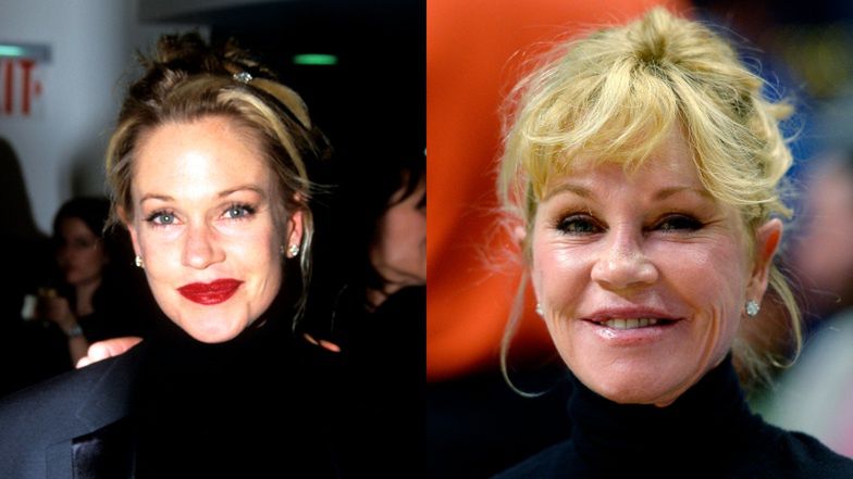 Te gwiazdy pożałowały operacji plastycznych