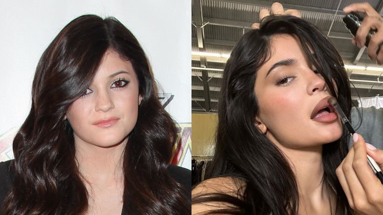 Tak zmieniła się Kylie Jenner
