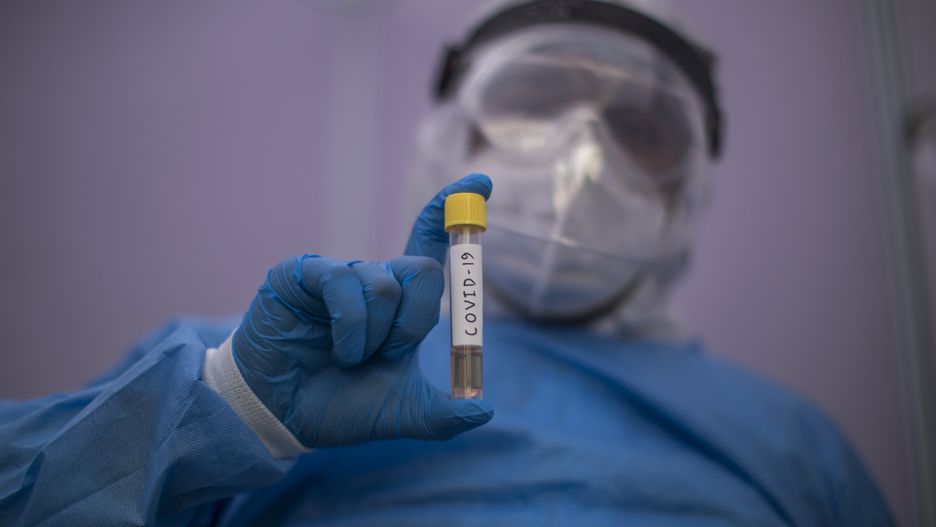 NEW DELHI, INDIA - APRIL 07: A laboratory technician from Dr. Dangs Lab holds a coronavirus testing tube at a drive-through testing service at the Punjabi Bagh center of Dr. Dangs Lab, as India remains under an unprecedented lockdown over the highly contagious coronavirus (COVID-19) on April 07, 2020 in New Delhi, India. Dr. Dangs Lab, one of the private labs in the country allowed to test for coronavirus, is the country's first drive-through COVID-19 testing centre. As India remains under an unprecedented lockdown the number of Covid-19 cases has crossed the 4000 mark with 136 deaths and the provincial governments have identified over 30 hotspots. Most reports say as the 21-day lockdown ends on April 14, the Narendra Modi government will keep these hotspots under stringent restrictions and ramp up the testing. India ranks extremely low in the coronavirus-hit countries list based on the number of tests done per million population. India has reported less than 4,300 infected cases and 130,000 tests so far. This means India has carried out 93 tests per million population and reported only three cases per million population. (Photo by Yawar Nazir/Getty Images)