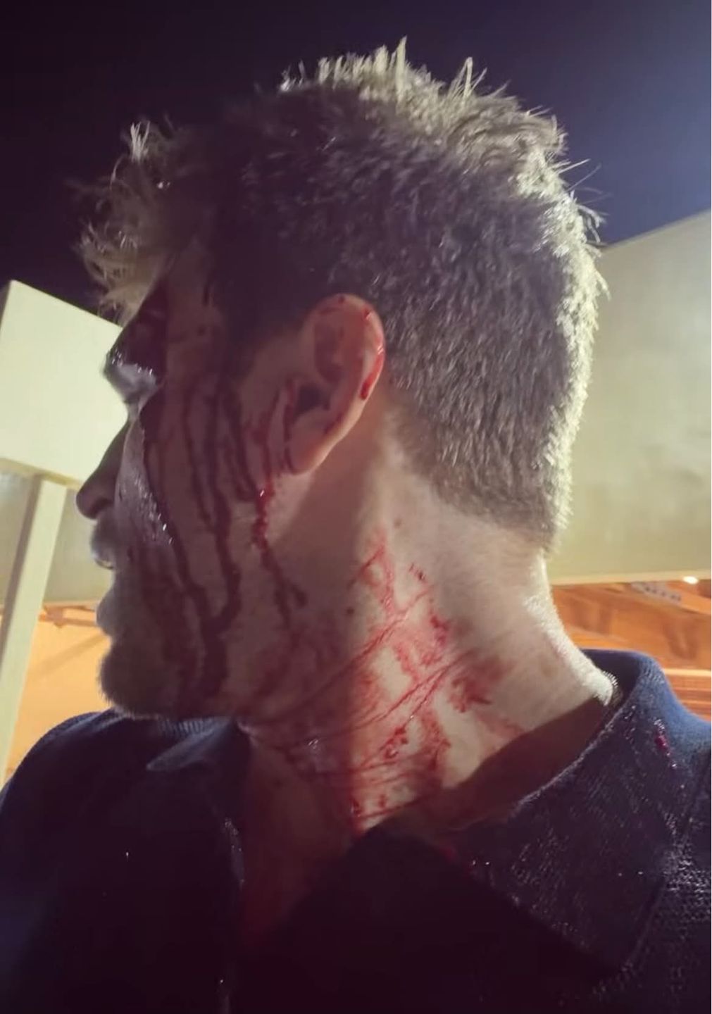 Keegan Allen
