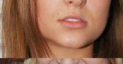 Co się stało z jej ustami?