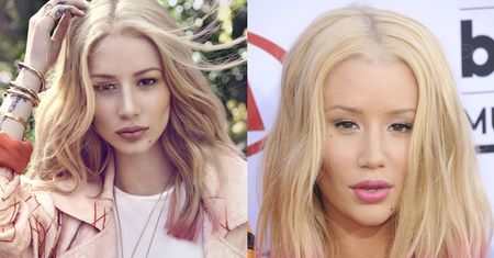 Iggy Azalea o operacji nosa: "Nie zaprzeczam. Zaprzeczanie JEST KIEPSKIE"