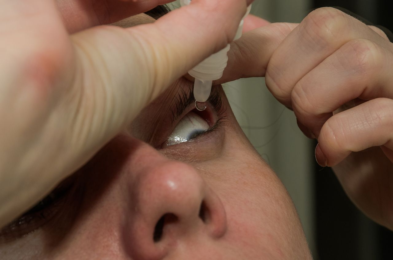 Bimatoprost – wskazania, przeciwwskazania, stosowanie, skutki uboczne