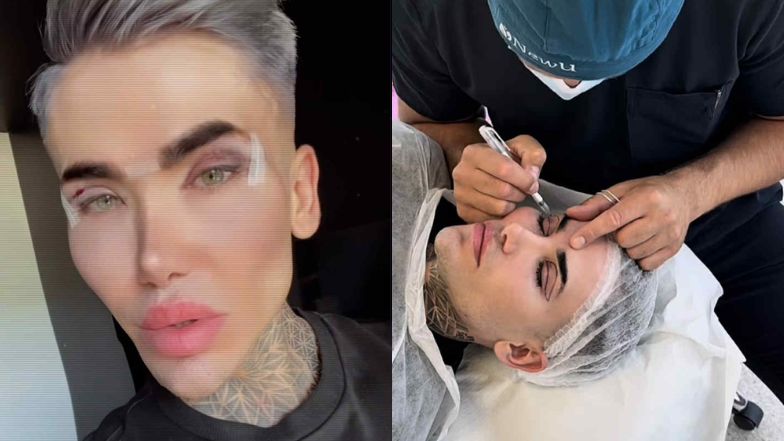 Polski "żywy Ken" zrobił sobie powieki. Są zdjęcia z kliniki