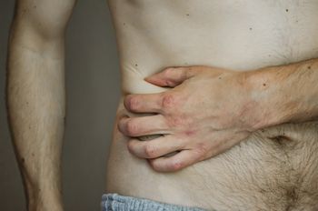 Naukowcy mówią, co "karmi" guza. Tak ograniczysz ryzyko raka wątroby