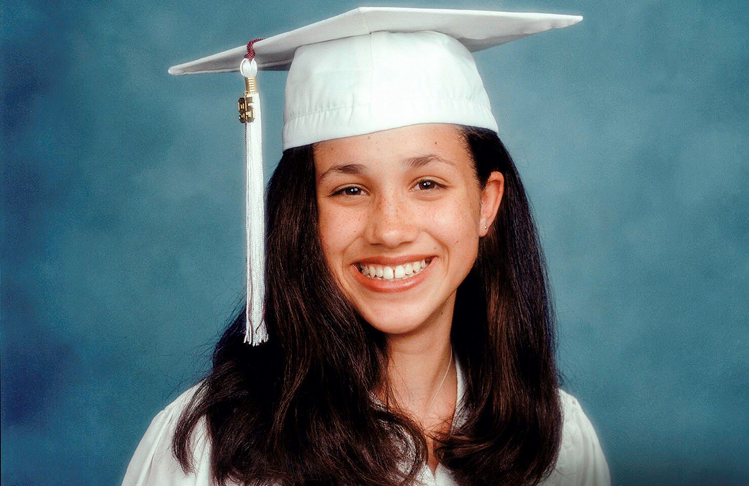 Meghan Markle poprawiła uzębienie