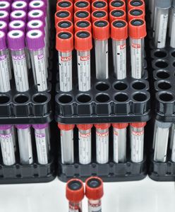 Japońska księżniczka Yoko zachorowała na koronawirusa