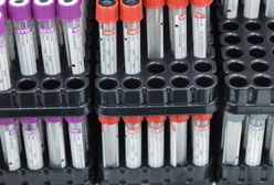 Japońska księżniczka Yoko zachorowała na koronawirusa