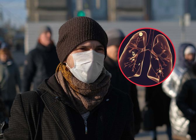 Eksperci prognozują, że w związku z kryzysem uchodźczym w Polsce liczba chorych na gruźlicę będzie wzrastać