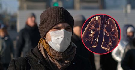 W szpitalach przybywa chorych na gruźlicę. Pulmonolog wskazuje niepokojące objawy