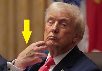 Plaster na dłoni Trumpa. Jego rzeczniczka zabrała głos